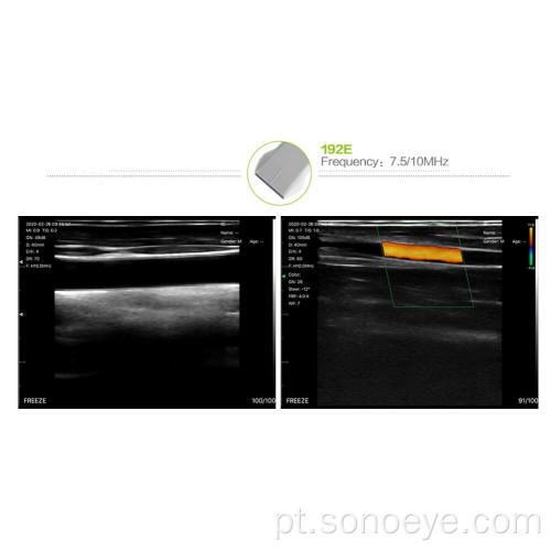 Ultrassom wifi sem fio 192e linear